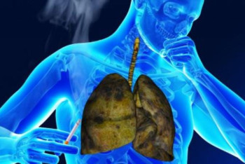 Фотография к новости: Бронхит. Пайда болу себептері мен аурудың алдын алу жолдары