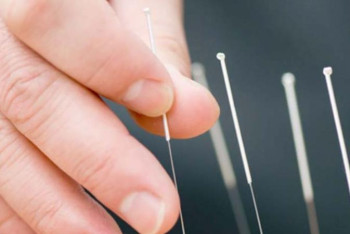 Фотография к новости: Қорғаста «алтын инелер» табылды