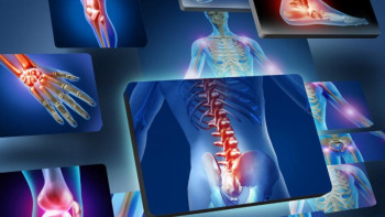 Фотография к новости: Алматыда Қазақстан ревматологтарының ІІ конгресі өтіп жатыр