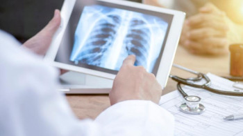 Фотография к новости: Қостанай облысында туберкулезбен сырқаттанатындар саны азайып келеді