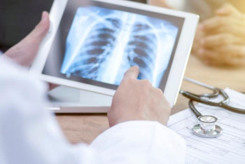 Фотография к новости: Қостанай облысында туберкулезбен сырқаттанатындар саны азайып келеді