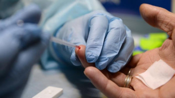 Фотография к новости: Елордада ЖИТС құрбандарын еске алу күніне орай акция өтеді