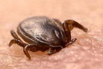 Фотография к новости: Өскеменде кене шаққан жасөспірім жансақтау бөліміне түсті