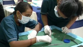 Фотография к новости: Жеті жасар баланың 526 артық тісі жұлынды