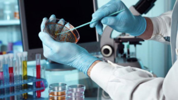 Фотография к новости: Күйдіргі ауруының тіркелуі бойынша жағдай тұрақты – ДСМ