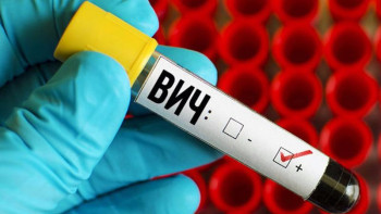 Фотография к новости: АИТВ-дан қорғану тәсілі табылды