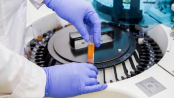 Фотография к новости: Ғалымдар балалардың организмінде 11 түрлі микропластик бар екенін анықтады 