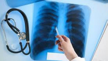 Фотография к новости: Елімізде туберкулезге қарсы вакцина егу тоқтатылды