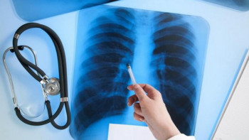 Фотография к новости: Елордада рентгенге түсіру акциясы жалғасуда