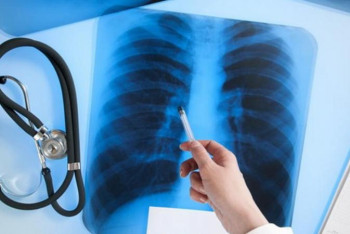 Фотография к новости: Елордада рентгенге түсіру акциясы жалғасуда