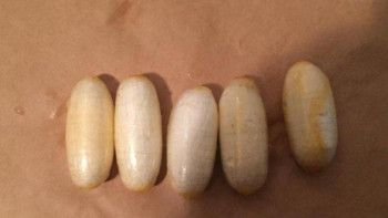 Фотография к новости: Қазақстандықтың асқазанынан кокаиннің 42 капсуласы табылды