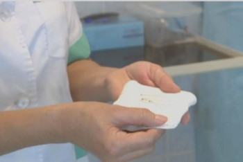 Фотография к новости: 1,5 жасар бүлдіршін 5 ине жұтып қойған