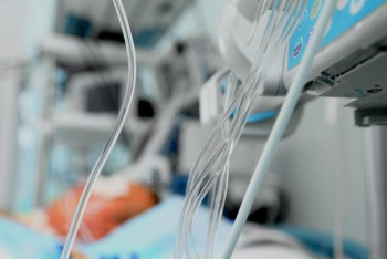 Фотография к новости: Күйеуі өртеп жіберген әйелдің жағдайы: Есін жиды, бірақ өкпесі жұмыс істемейді