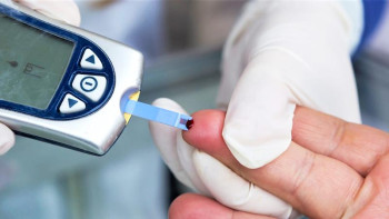 Фотография к новости: Қандағы холестерин деңгейін не төмендететінін білесіз бе?