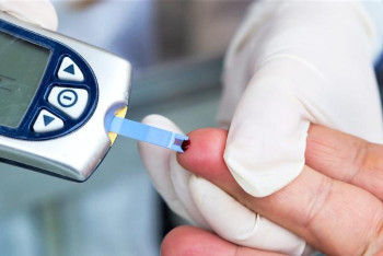 Фотография к новости: Қандағы холестерин деңгейін не төмендететінін білесіз бе?