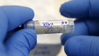 Фотография к новости: Қазақстан коронавирусты анықтауға қажет праймерлерді сатып алу рәсімін бастады 