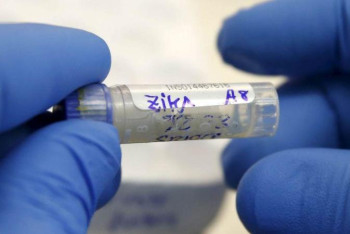 Фотография к новости: Қазақстан коронавирусты анықтауға қажет праймерлерді сатып алу рәсімін бастады 