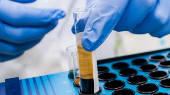 Фотография к новости: Ресейден коронавирусты анықтайтын тест жеткізілді