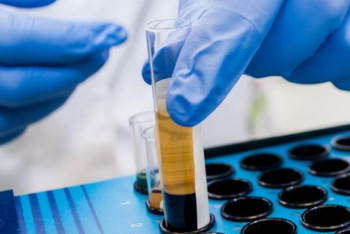 Фотография к новости: Ресейден коронавирусты анықтайтын тест жеткізілді