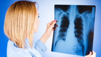 Фотография к новости: 10 жылда туберкулезбен ауыратындар саны 3 есе төмендеді