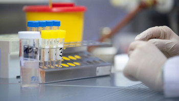 Фотография к новости: Қазақстанда коронавирус індетінен бір адам қайтыс болды