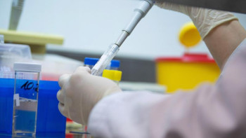 Фотография к новости: Қосшыда қайтыс болған адаммен байланыста болғандардан инфекция анықталып жатыр