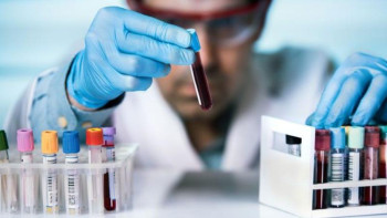 Фотография к новости: Коронавирус: 8-29 сағат аралығындағы диагностика 