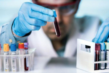 Фотография к новости: Коронавирус: 8-29 сағат аралығындағы диагностика 