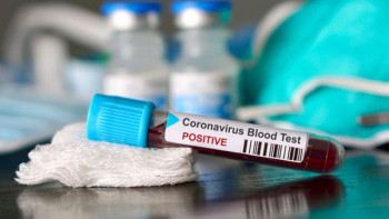 Фотография к новости: Түркістанда коронавирус жұқтырған бесінші азамат Жетісай тұрғыны