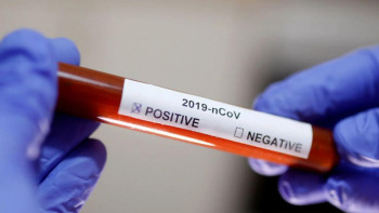 Фотография к новости: Коронавирус: Алматыда екі адамның жағдайы ауыр