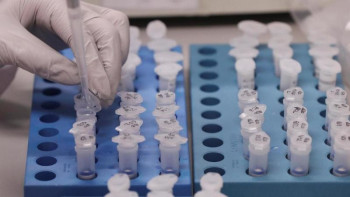 Фотография к новости: Коронавирус жұқтырған науқастардың анализі Шымкентте анықталады