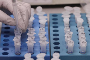 Фотография к новости: Коронавирус жұқтырған науқастардың анализі Шымкентте анықталады