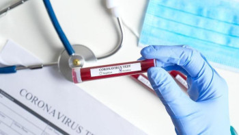 Фотография к новости: СҚО-да бір тәулікке жетпей коронавирусқа шалдыққандар саны екі есе артты