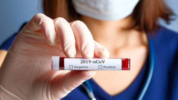 Фотография к новости: Коронавирус шаш арқылы тарай ма?