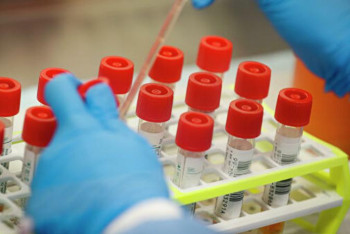 Фотография к новости: Коронавирус: Қызылорда облысында тағы 2 жағдай тіркелді