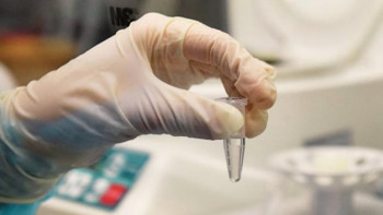 Фотография к новости: Түркістан: Науқастармен жақын қарым-қатынаста болған 380 адам анықталды