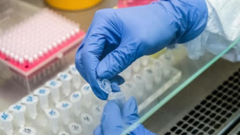 Фотография к новости: Коронавирус. ШҚО-да қауіпті індеттің бесінші жағдайы тіркелді