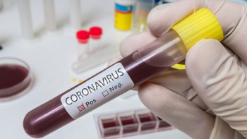 Фотография к новости: Маңғыстау облысында вирус жұқтырған тағы екі адам анықталды