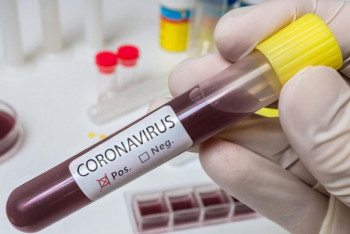 Фотография к новости: Маңғыстау облысында вирус жұқтырған тағы екі адам анықталды