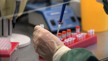 Фотография к новости: Қостанай облысында тағы екі адам коронавирус жұқтырды