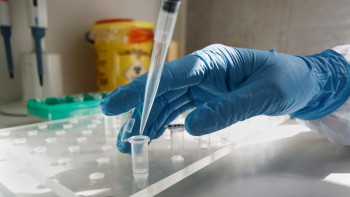 Фотография к новости: Коронавирус. Індетті жұқтыру бір тәулікте 13 пайызға өсті