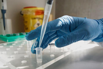 Фотография к новости: Коронавирус. Індетті жұқтыру бір тәулікте 13 пайызға өсті