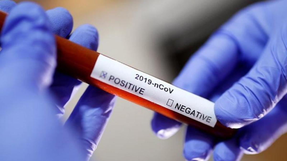 Пандемиямен күрес – мемлекеттік басқару тиімділігін сынайтын әлемдік тест﻿