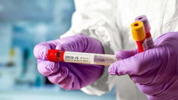 Фотография к новости: Індет жұқтырған елордалық бес науқастың жағдайы ауыр  ﻿