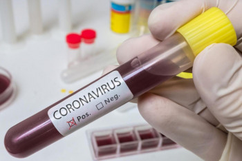 Фотография к новости: ІІМ бір қызметкері коронавирус инфекциясын жұқтырған