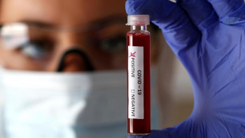 Фотография к новости: Алматыға 5 мыңнан аса экспресс-тест жеткізілді