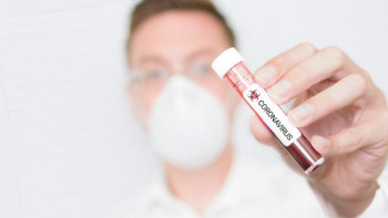 Фотография к новости: Шекара қызметінің 54 курсанты індет жұқтырған