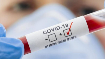 Фотография к новости: Алматыда індет жұқтырған медицина қызметкерлерінің саны 234 адамға жетті