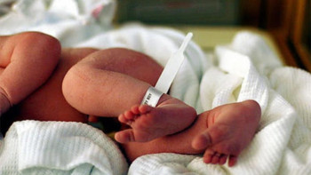 Фотография к новости: Еріктілер шала туған сәбилердің өмірі үшін күресіп жүр