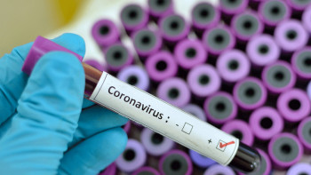 Фотография к новости: Алматыда бір тәулікте 31 адам індет жұқтырды